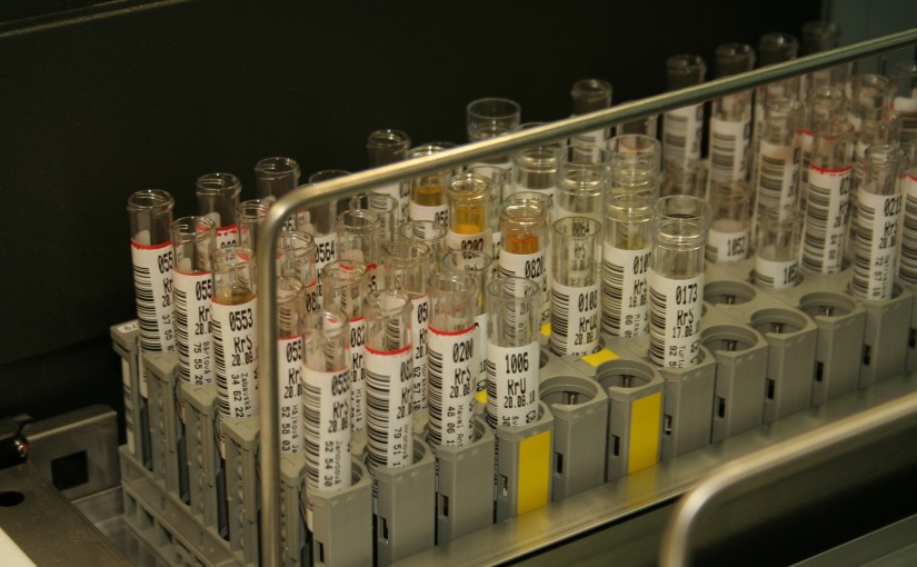 În viitor, analiza urinei ar putea înlocui analizele de sânge şi biopsiile